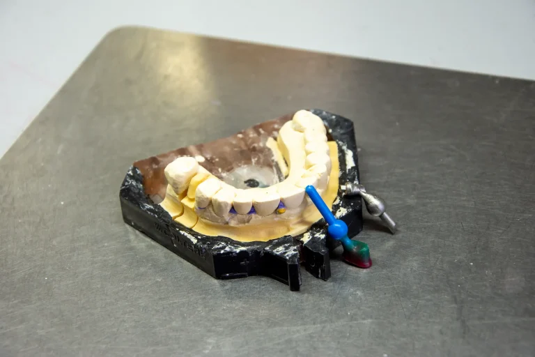 Diennevi Laboratorio Odontotecnico - gli impianti